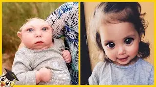 20 Bambini Che Nascono Solo Una Volta Ogni Mille Anni