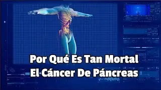 Por Qué Es Tan Mortal El Cáncer De Páncreas