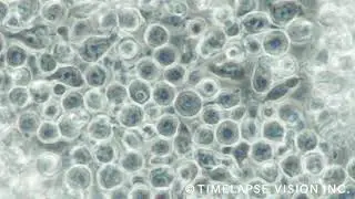 T lymphocyte - T細胞 -