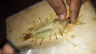 Dissection of prawn | Nervous system|