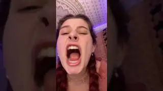 Reasons why you Should be Wearing your Retainers