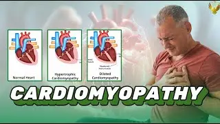 Cardiomyopathy: A Biotech Perspective on Diagnosis,Treatment, and Market Trends in 2025
