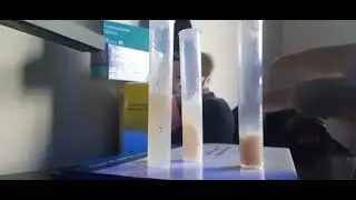 Chest infection & Chest pains Warning Sputum Samples