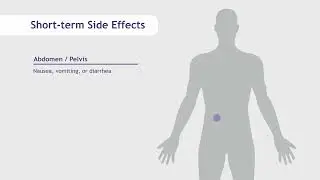 Side Effects of Radiation Therapy | SERO