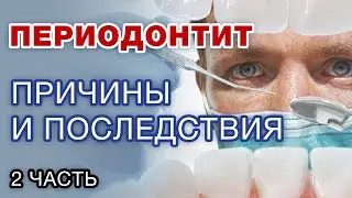 CAUSES of periodontitis / Consequences of periodontitis Part 2