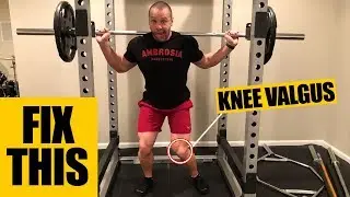 How to Fix Knee Valgus - One Simple Movement! | Tiger Fitness