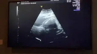 Waylon Sami Bruce 8-15-21