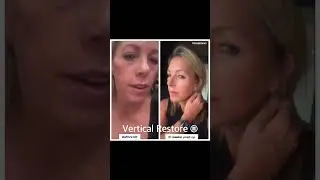 INSTANT Refresh! Gorgeous Facelift Before & After!