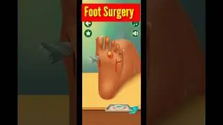 Foot Surgery 3D Animation 