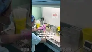 Анализ спермограммы по Крюгеру