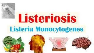 Listeriosis (Listeria Monocytogenes) | Sources, Pathophysiology, Symptoms, Diagnosis, Treatment