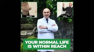 Deep Brain Stimulation (DBS) by Prof. Ali Zirh - Before and After