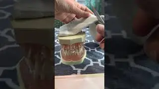 How to make fake cheeks for your typodont