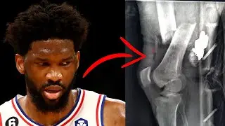 This Will END Joel Embiid's Career...