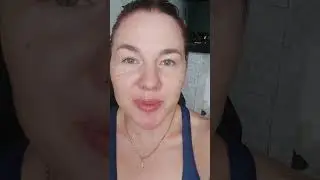 Сама себе колю ботокс. Разметка. Full Face. И результат через пару часов.