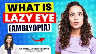 What is LAZY EYE (Amblyopia) and Its Causes | How To FIX Lazy Eyes | Vision Eye Centre