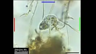 Microbe Quest - Lacrymaria and its squooshy neck