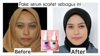 SERUM SCARLET SEBAGUS INI