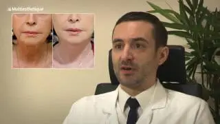 Lifting : ce qu’il faut savoir avant de se lancer - Dr. Christophe Laveaux