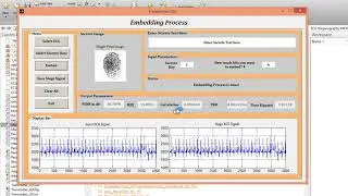 Curvelet based ECG steganography MATLAB source code