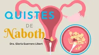 Huevos de Naboth …Debo preocuparme?