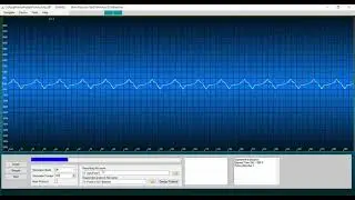 LFP/LTP feature extraction Tutorials