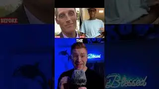He Took Pills That Turned Him Black