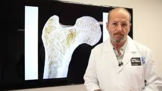 Lesión Edema Óseo