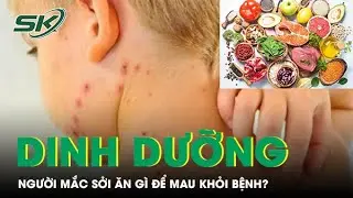 Chế độ dinh dưỡng giúp người mắc sởi nhanh khỏi bệnh | SKĐS