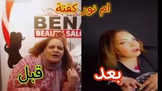 ام نور كفتة خلعت الحجاب و بقت ملكة جمال بقت موزه 😂😂😂
