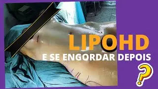 PERFURAÇÃO NA LIPO HD, ENGORDEI APÓS A LIPO HD E AGORA ?
