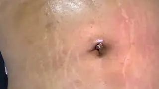 Navel Play Continues 