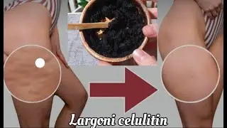 HOW TO REMOVE CELLULITE AT HOME! RECIPES AND INSTRUCTIONS. READY FOR THE BEACH! 😎