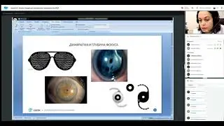 Коррекция пресбиопии современными ИОЛ, вебинар в 
