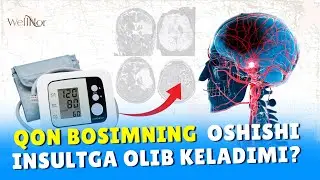 МЎЖИЗАНИ КЎРИНГ! УШБУ ГИЁХНИ ИЧДИМ ВА ҚОН БОСИМИМ ЙЎҚОЛДИ