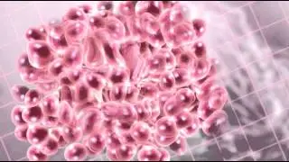 Cancer Cells