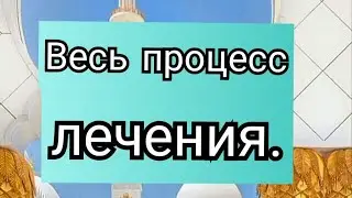 19).Весь процесс лечения.