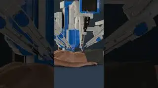 How Robotic Prostate Surgery Is Performed? | Robot Assisted Prostatectomy (3D Animation)