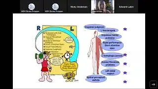 MDH Stroke Monthly Education Series: Mysterious Stroke Case Studies (Oct 2022)