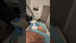 Marilu's Transformation: Venus Legacy Body Treatment at Novuskin
