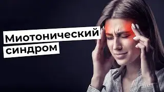 Миотонический синдром