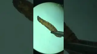 Bacillus thuringiensis 