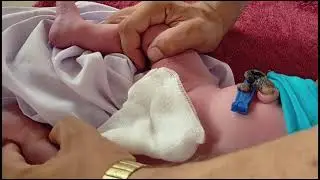 بچوں کا ختنہ کیسے کیا جاتا ہے  || Seven days old baby KHatna How To Do in islam
