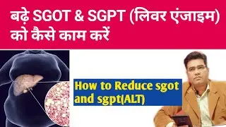 How to Reduce High SGOT and SGPT at home - Explained in Hindi | Raised Liver Enzyme Treatment