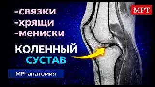 Knee MRI: Basic Anatomy Step-by-Step