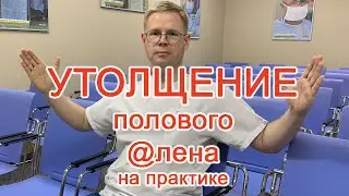 Утолщение полового @лена на практике / Доктор Черепанов