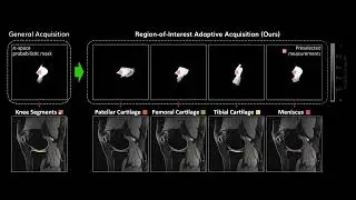 Poster 45. Region-of-Interest Adaptive Acquisition for Accelerated MRI