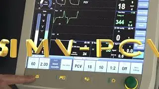 Synchronized Mechanical Ventilation with Pressure Support (SIMV-PCV)