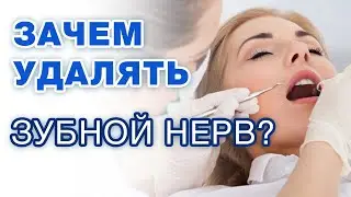 Зачем удалять зубной нерв? В каких случаях удаляют нерв зуба? / Как удаляется нерв зуба?