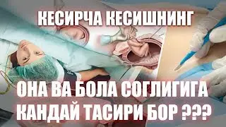 Kesircha kesishning Ona va Bola sogligiga  qanday tasiri bor - Кесирча кесиш она ва болага тасири